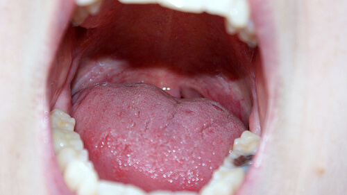 ALT TITLE mouth4