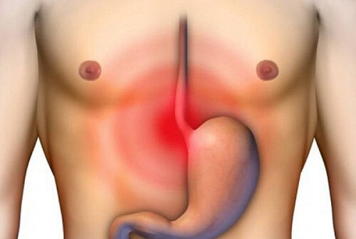 Symptoms of Inflammation of the Esophagus