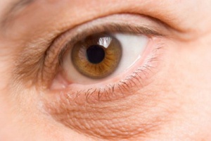 How to Lighten or Eliminate Eye Bags
