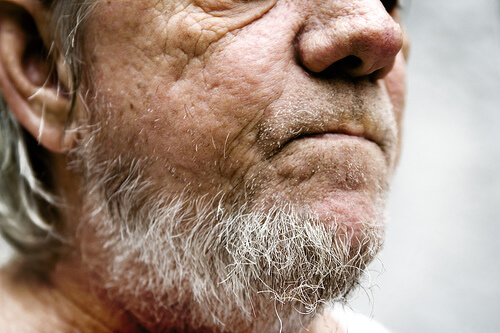 gray hair