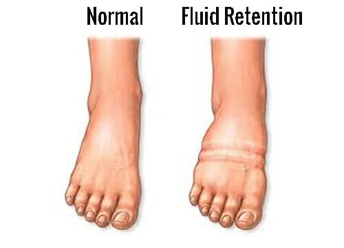 How to Fight Fluid Retention