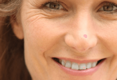 Food and Habits that Cause Premature Wrinkles