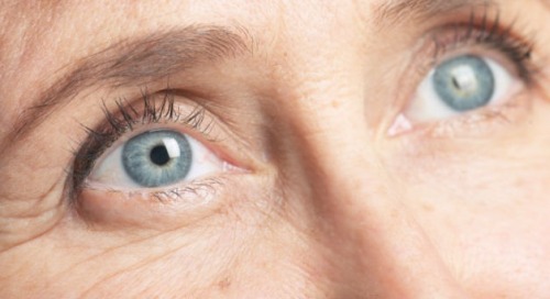 Food and Habits that Cause Premature Wrinkles