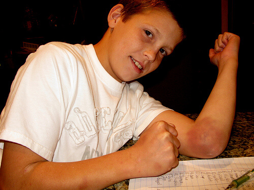 A boy with a bruise on his elbow.