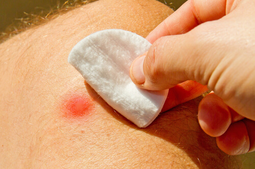 Covering a boil with a cotton pad