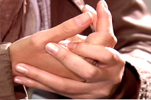 woman with swollen hands