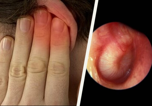 Inside a swollen ear canal 