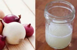 How to Make Onion Juice to Prevent Hair Loss