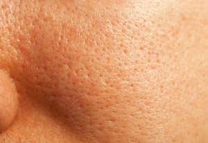 Close Pores Naturally Using These Methods