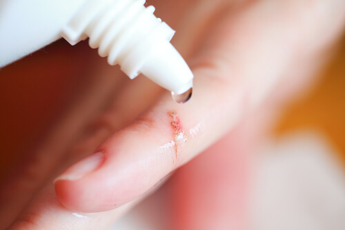 Antiseptic liquid to help with boils