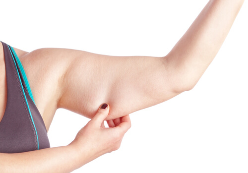 Woman holding loose skin of her arm