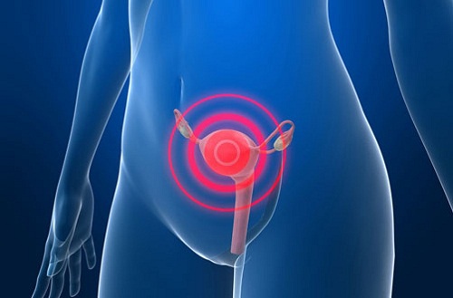 Warning Signs of Possible Cervical Cancer Warning Signs of Possible Cervical Cancer
