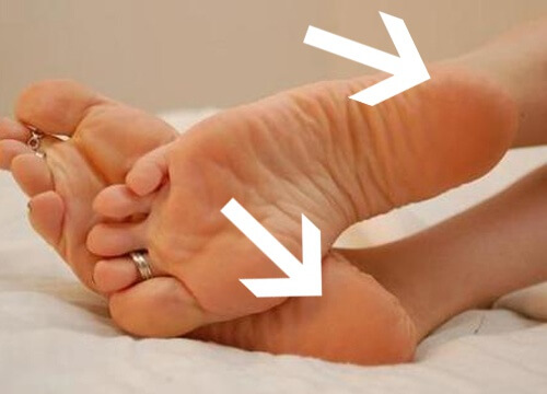 The Causes of Heel Pain