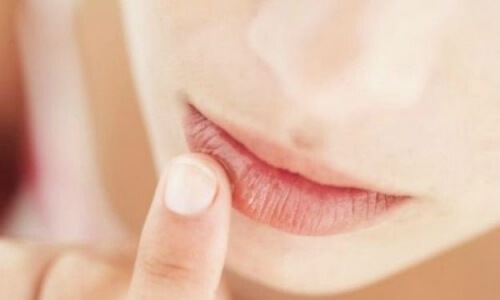 Woman with dry lips