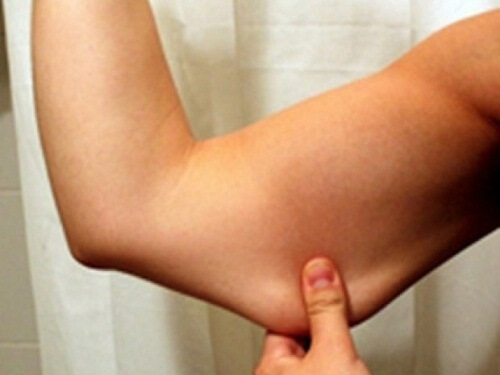 Say goodbye to loose skin on your arms and legs with these tips!