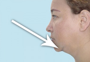 4 Easy Tips for a Slimmer Neck