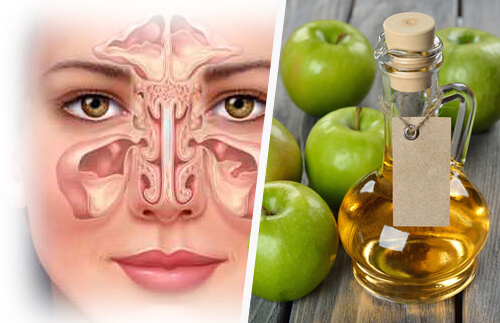 paranasal-sinuses