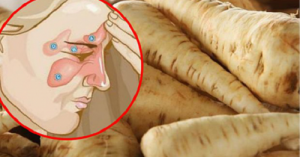 How to Fight a Sinus Infection in 5 days