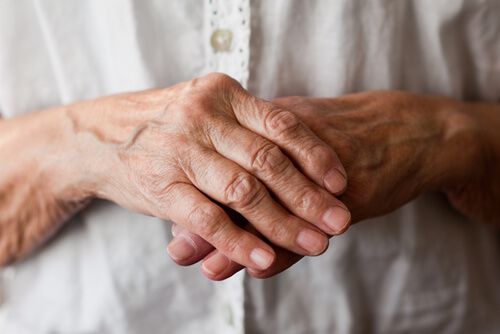 Elderly person with arthritis in hands