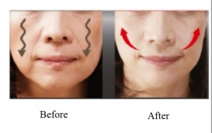 4 Tips to Smooth and Lift Sagging Cheeks