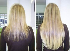 Natural Remedies and Tips for Rapid Hair Growth