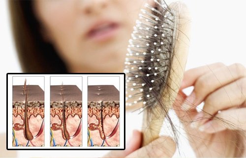 Find Out Why You’re Losing Your Hair Find Out Why You’re Losing Your Hair