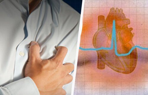 Heart Arrhythmias: Symptoms and Consequences