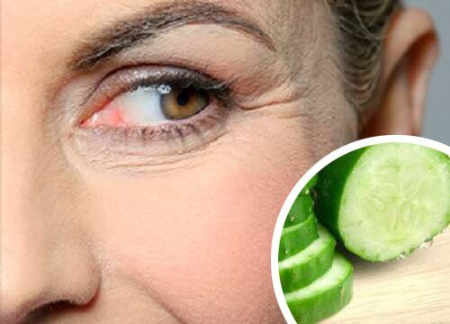 Some Natural Tips that are Proven to Reduce Wrinkles