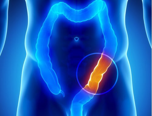 The colon of a person highlighted with a circle