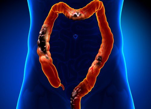 abdominal pain