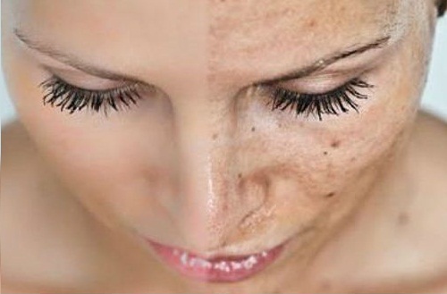 Smooth skin versus textured skin
