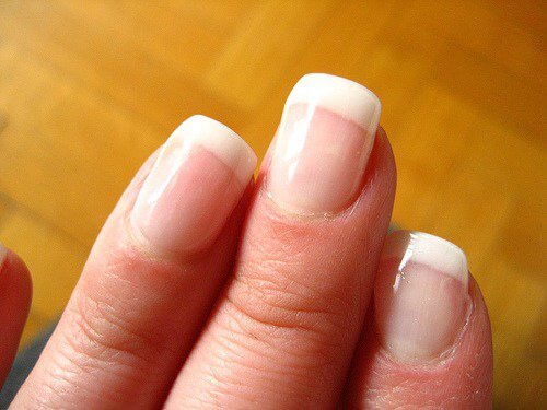 healthy nails are pinkish in color
