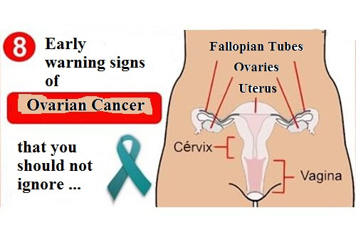 Ovarian cancer warning signs.