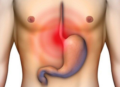 Do You Have Heartburn or Acidity? They’re Not the Same! Do You Have Heartburn or Acidity? They’re Not the Same!