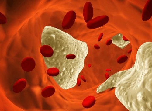 Learn About Cholesterol: Getting The Facts Straight