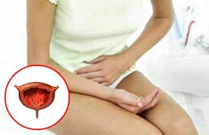 Causes of Burning Sensation with Urination in Women