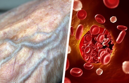 Improve Circulation Naturally and Live Better