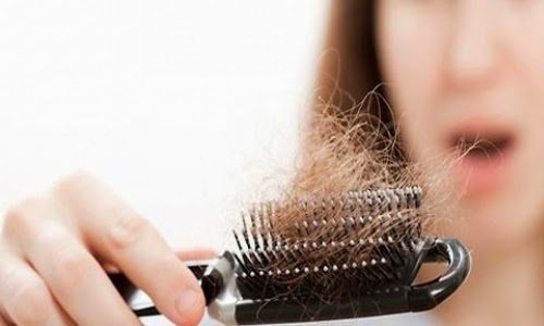 hair in a brush representing hair loss
