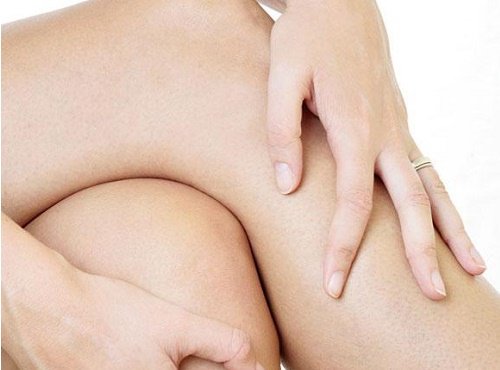 degenerative knee is a serious and common issue