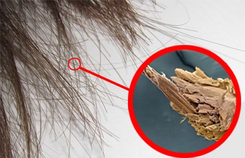 split-ends split ends