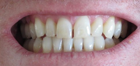 ALT TITLE teeth