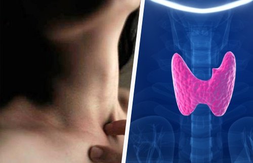 Foods that Help Regulate the Thyroid