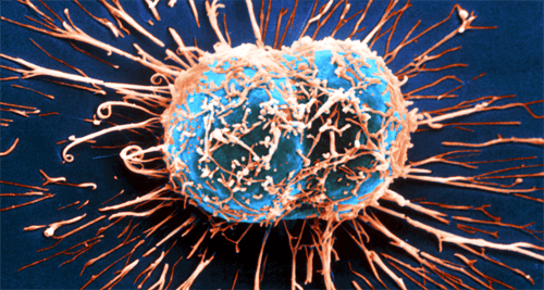 11 Early Warning Symptoms of Cancer that Often Get Ignored