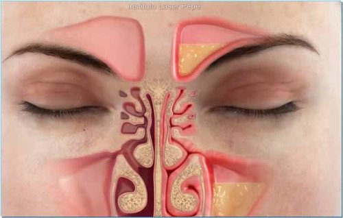 How to Alleviate Nasal Congestion in Under a Minute