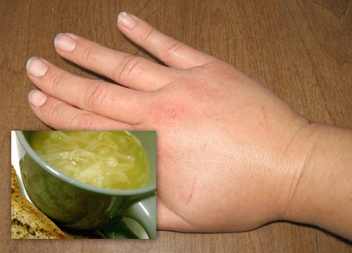 How to Use Onion for Fluid Retention