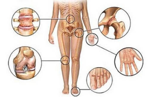 5 Natural Anti-Inflammatory Treatments for Joint Pain
