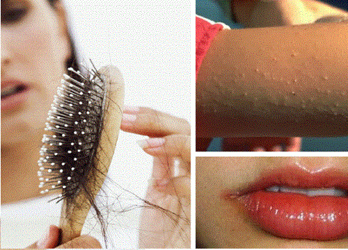 Possible Unusual Signs of Vitamin Deficiency