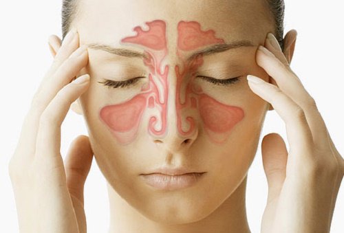Woman touching her temples to alleviate nasal congestion