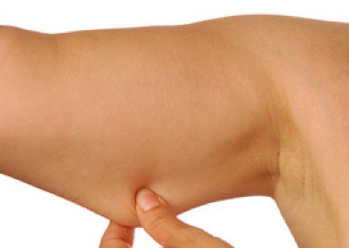 flabby arms