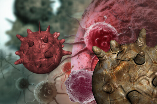 Illustration of cancer